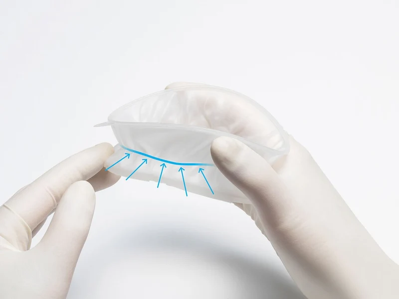 Ivoclar Optragate2 écarteur buccal x80